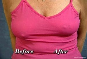 Bring It UP Instant Breast Lift