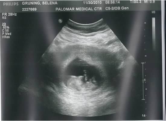 Ultra sound picture