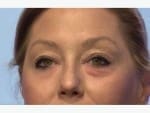 Instantly Ageless before and after picture of woman
