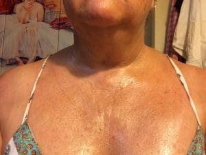 wrinkled womans neck