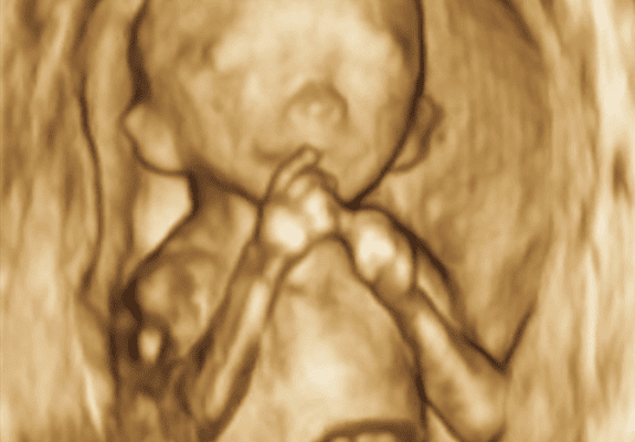 Ultra sound