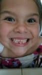 Alices Lose teeth Choose A Dentist