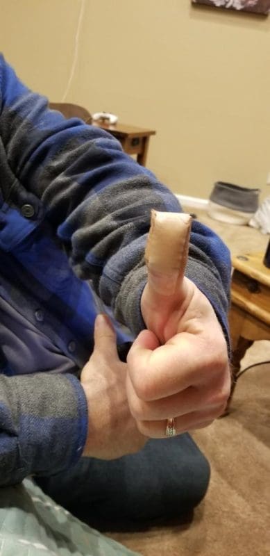 Man with a bandaged thumb