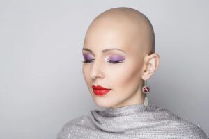 beautiful bald woman