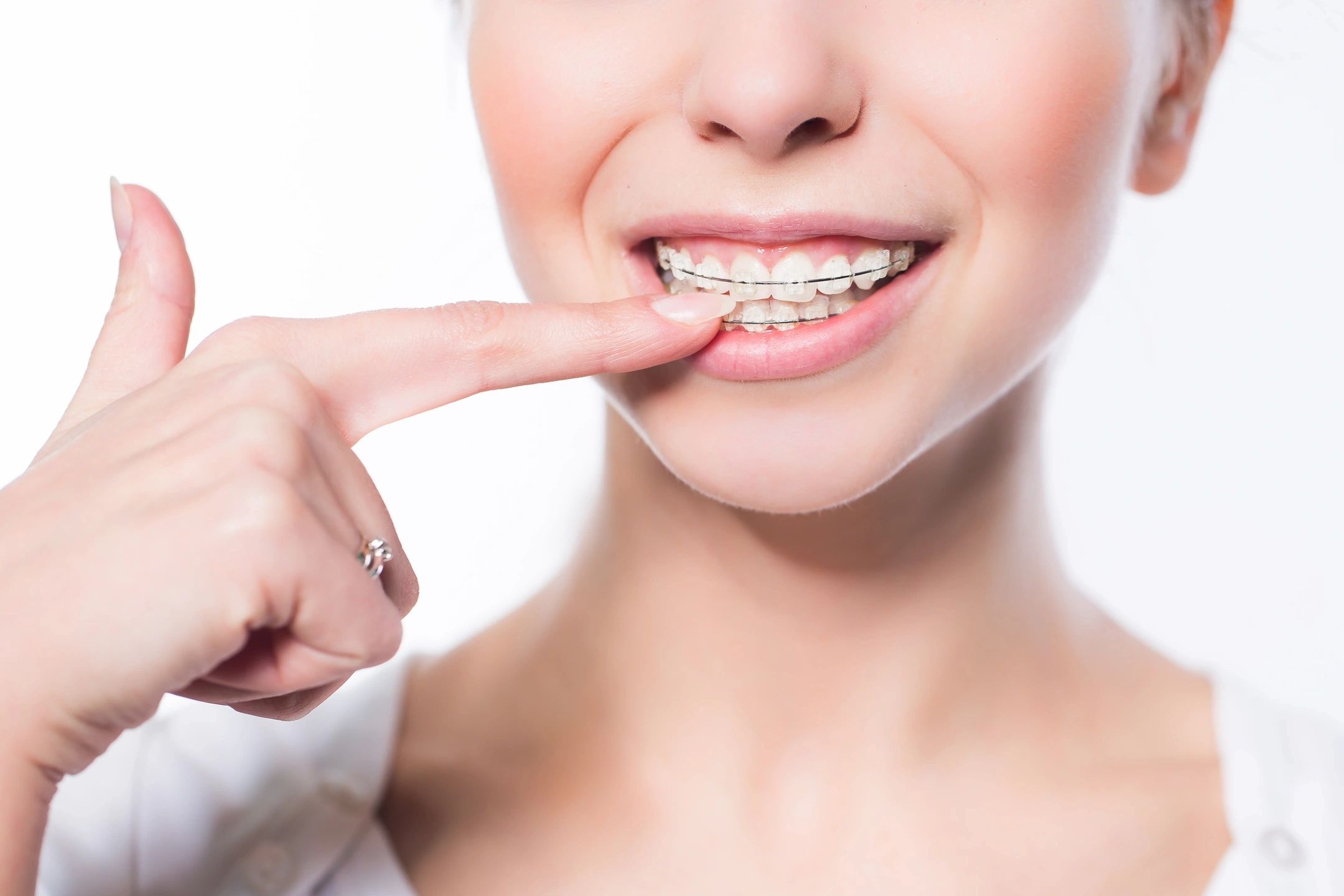 Girl with braces