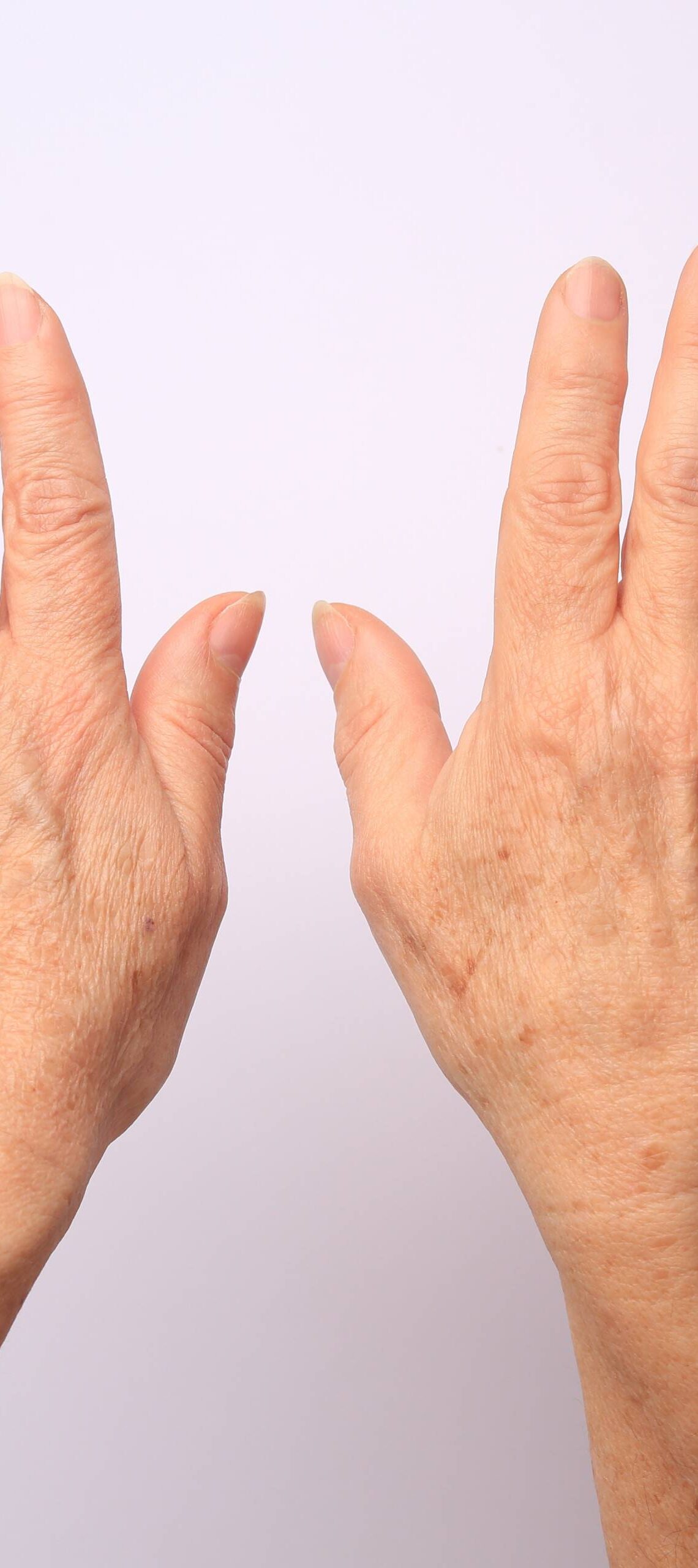 A pair of hands is held up against a light-pink background. The hands belong to a white person and have wrinkles.