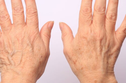 A pair of hands is held up against a light-pink background. The hands belong to a white person and have wrinkles.