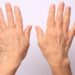 A pair of hands is held up against a light-pink background. The hands belong to a white person and have wrinkles.