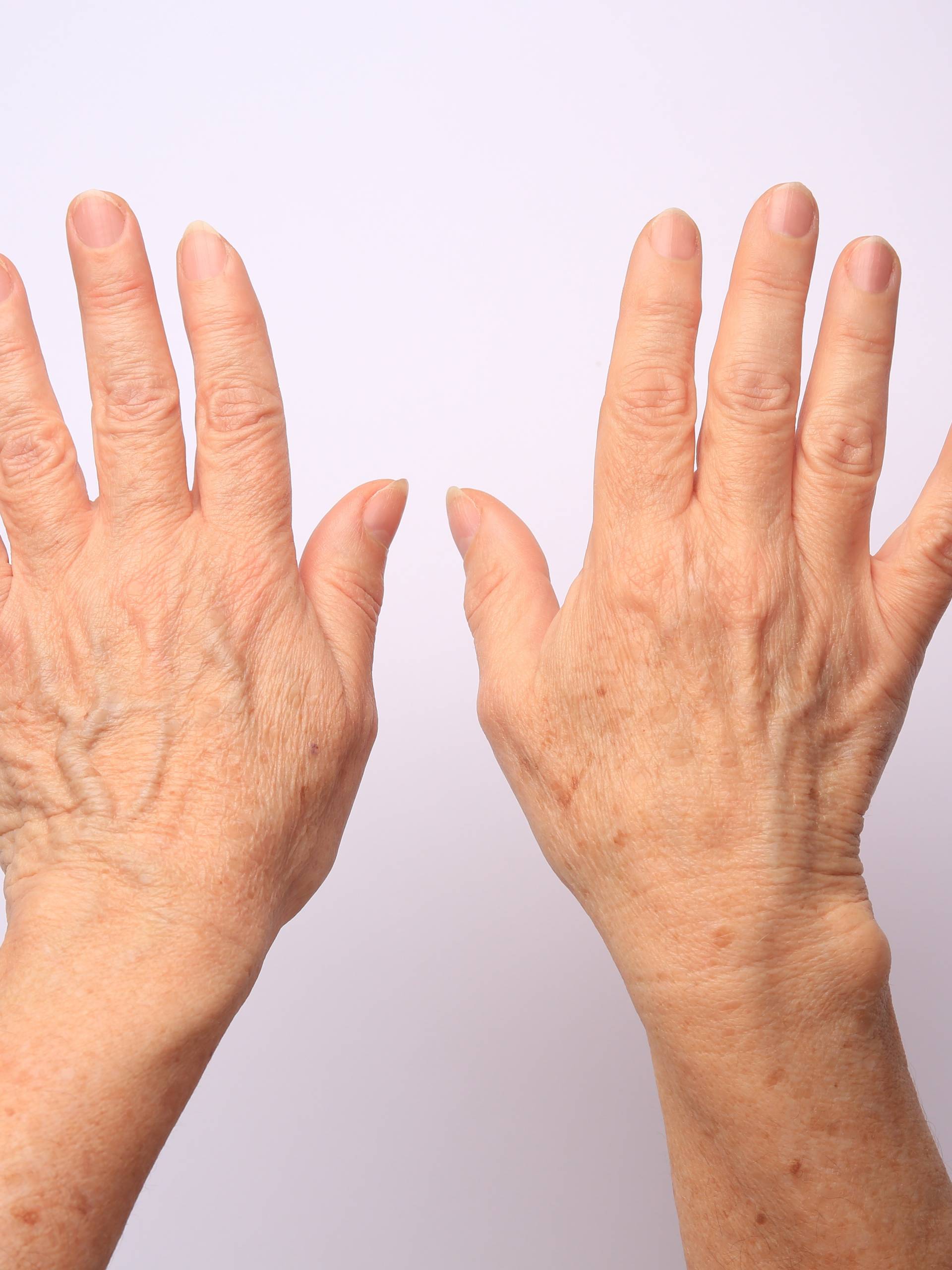 A pair of hands is held up against a light-pink background. The hands belong to a white person and have wrinkles.