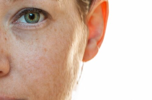 A woman is looking directly at the camera. Her skin has several blemishes on it and her hair is tucked behind her ear.