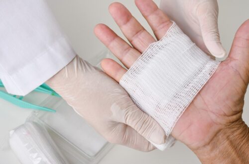 Urgent Care Someone holds their hand with the palm up. Someone else wearing latex gloves applies a gauze bandage over the hand.