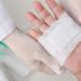 Urgent Care Someone holds their hand with the palm up. Someone else wearing latex gloves applies a gauze bandage over the hand.