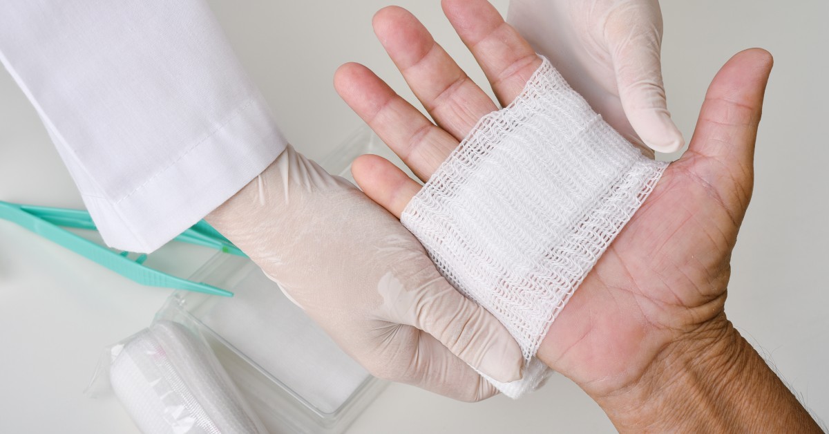 Someone holds their hand with the palm up. Someone else wearing latex gloves applies a gauze bandage over the hand.