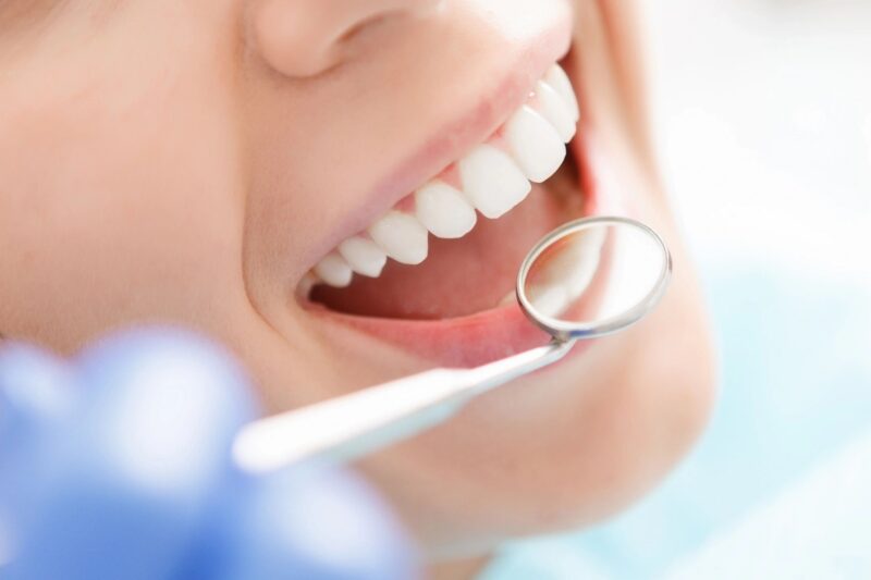 Dental implants Woman at dentist office with mirror